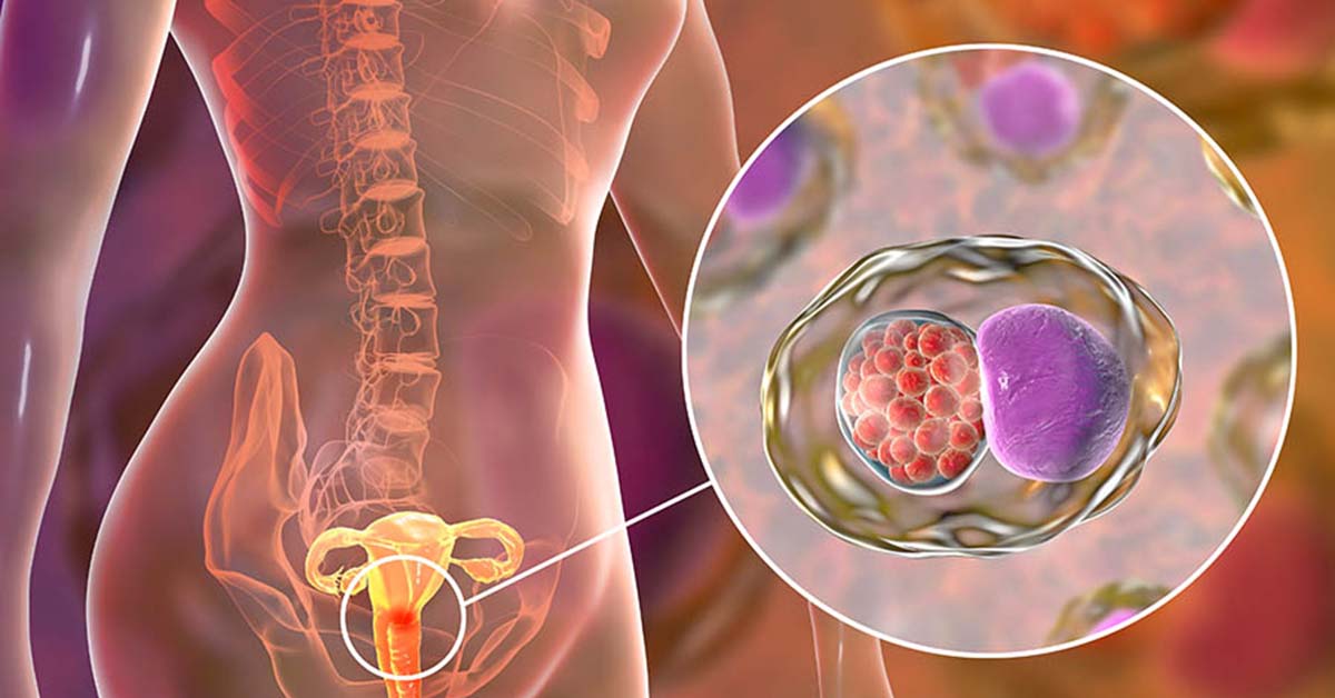 Chlamydia in Singapore