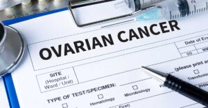 Ovarian Cancer Risk Factors