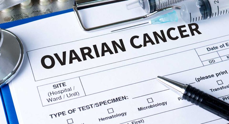 Ovarian Cancer Risk Factors