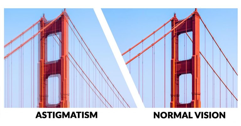 astigmatism normal vision