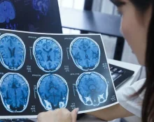 efek samping ct scan kepala - health365