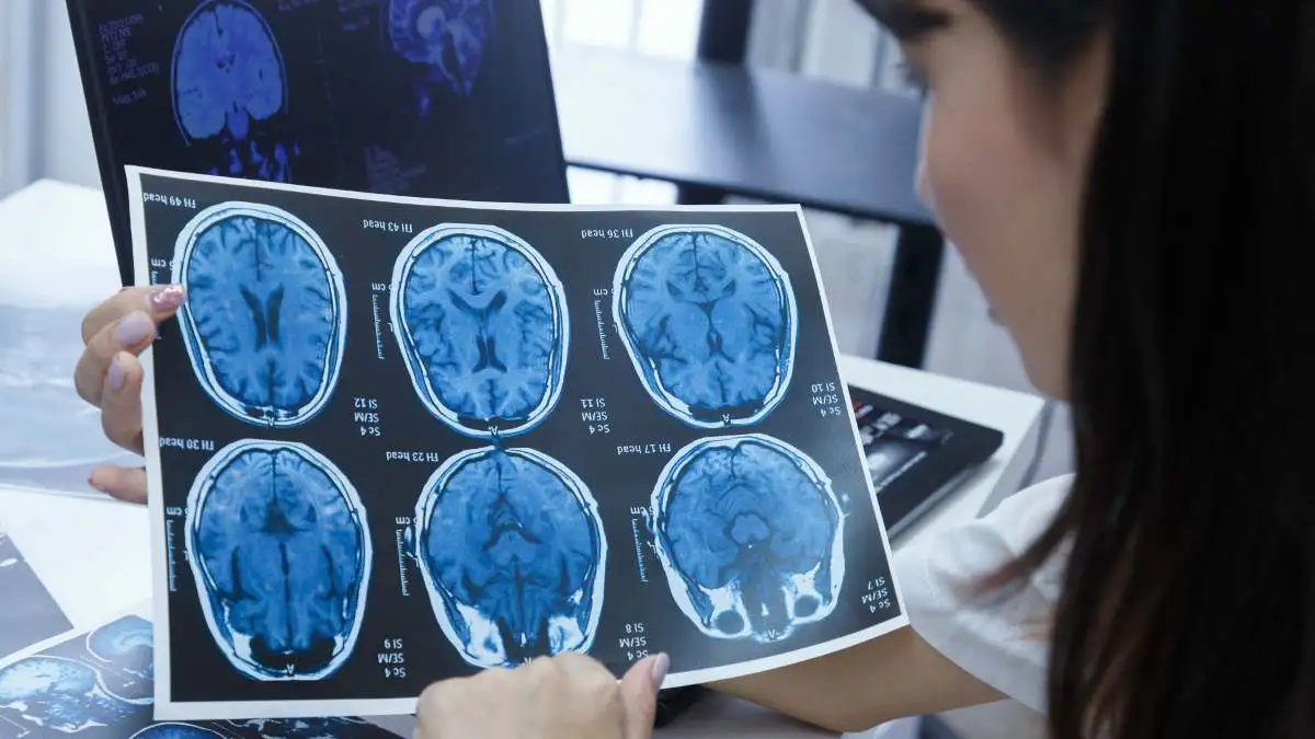 efek samping ct scan kepala - health365