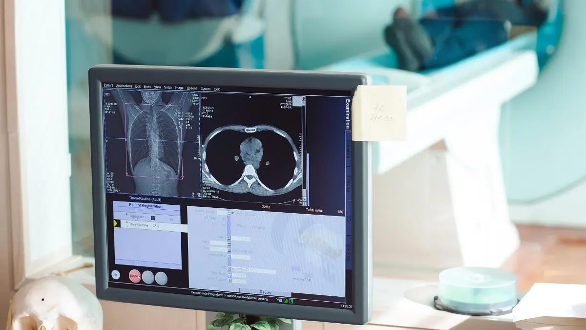 perbedaan ct scan dan mri - Health365