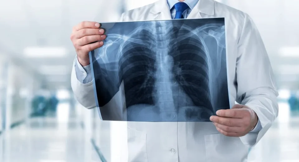 rontgen dada atau thorax - Health365