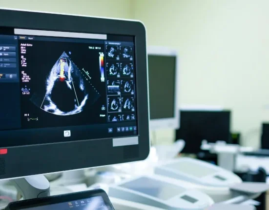 ultrasonografi atau usg - Health365