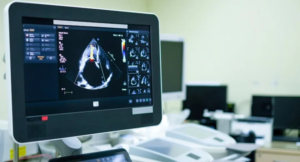ultrasonografi atau usg - Health365