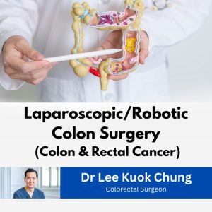 layanan yang ditawarkan oleh Dr Lee Kuok Chung, dokter bedah kolorektal