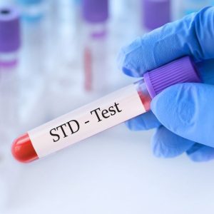 std test in malaysia